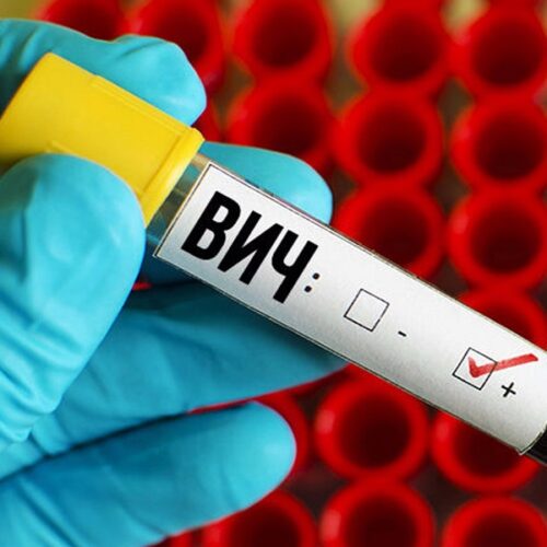 Эпидситуация по ВИЧ-инфекции в Гомельской области за январь-апрель 2025 года