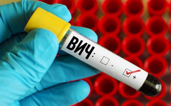 Эпидситуация по ВИЧ-инфекции в Гомельской области за январь-апрель 2025 года